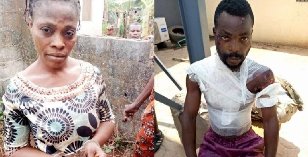 Woman Pours Hot Water On Husband; He Was Drunk