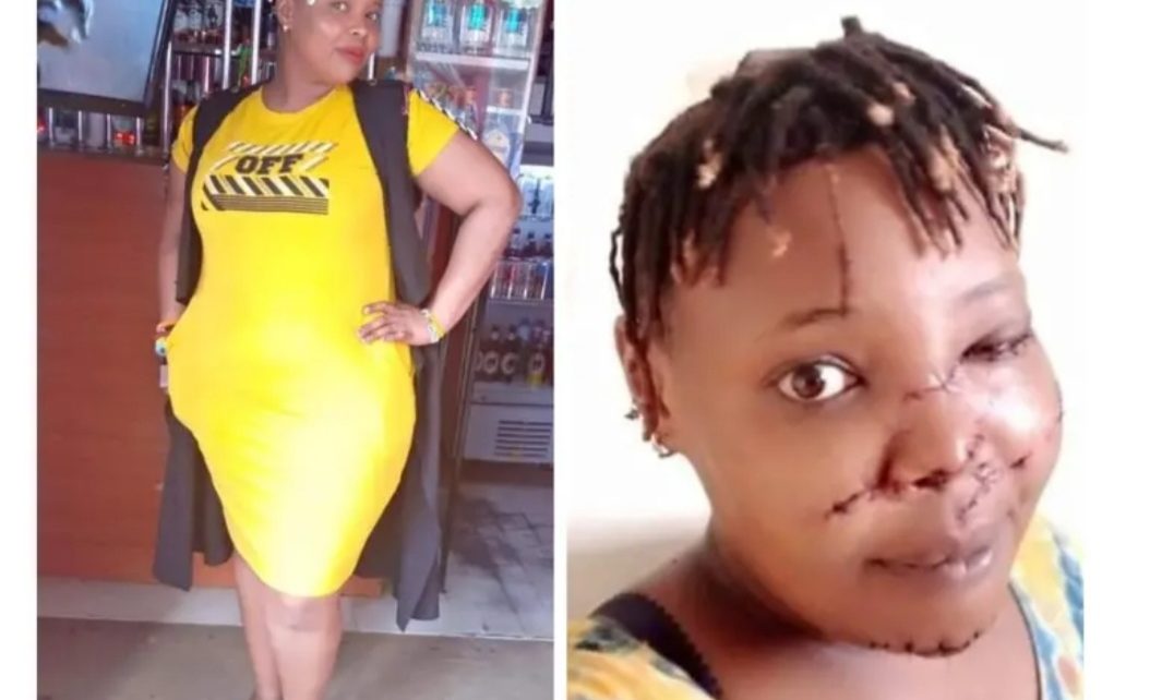 Beautiful Kenyan Lady Mercilessly Slashed On The Face By Insecure Ex-Boyfriend (PHOTOs)