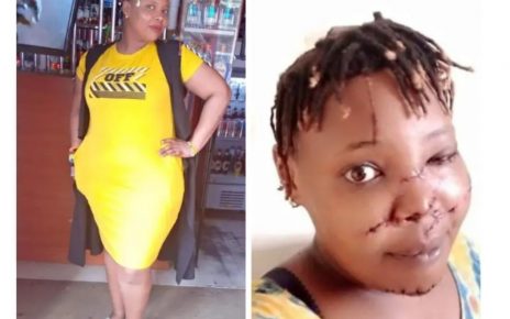 Beautiful Kenyan Lady Mercilessly Slashed On The Face By Insecure Ex-Boyfriend (PHOTOs)