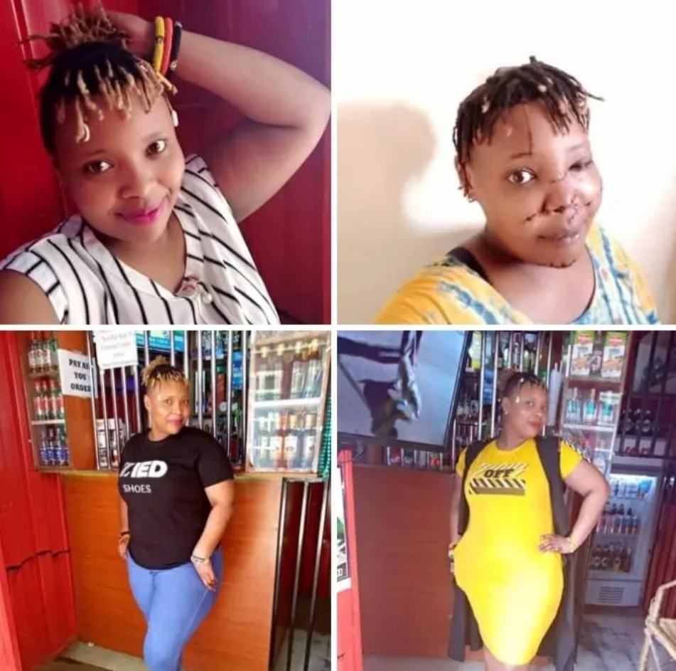Beautiful Kenyan Lady Mercilessly Slashed On The Face By Insecure Ex-Boyfriend (PHOTOs)