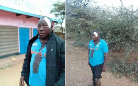 Pupils at Oldo in Isiolo brutally attack a teacher disfiguring his face(PHOTOs).