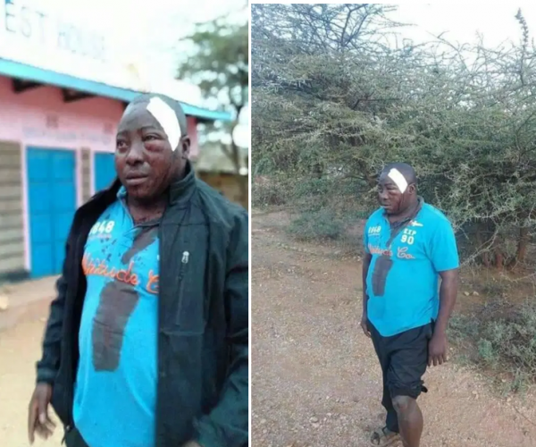 Pupils at Oldo in Isiolo brutally attack a teacher disfiguring his face(PHOTOs).