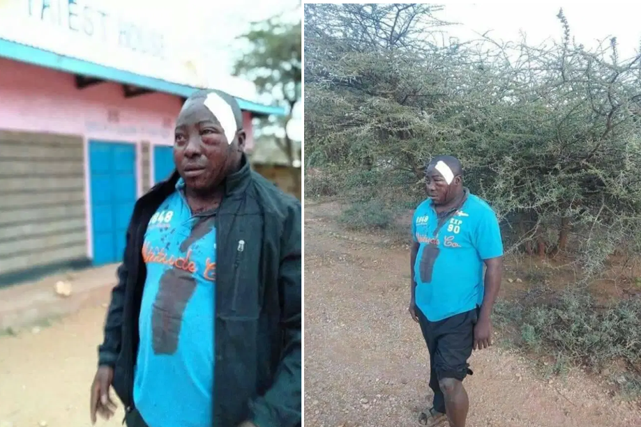 Pupils at Oldo in Isiolo brutally attack a teacher disfiguring his face(PHOTOs).