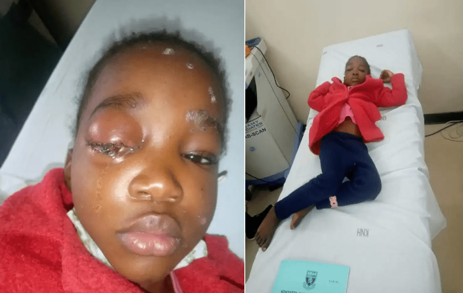 Teacher beats 5-year girl leaving her with injuries -This is inhuman (PHOTOs).