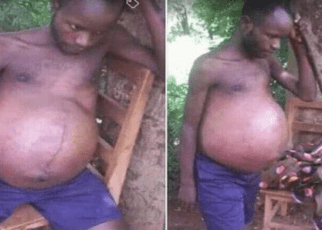Man who got ‘pregnant’ after sleeping with a married woman goes viral