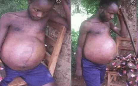 Man who got ‘pregnant’ after sleeping with a married woman goes viral