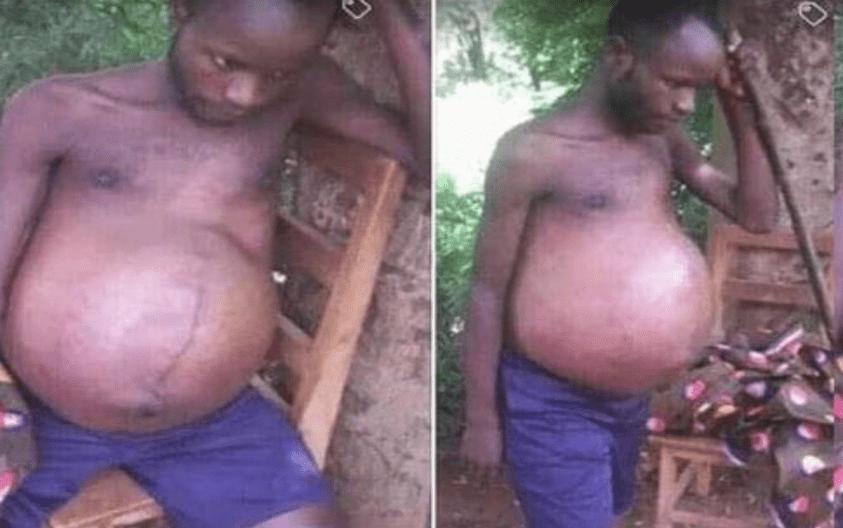 Man who got ‘pregnant’ after sleeping with a married woman goes viral