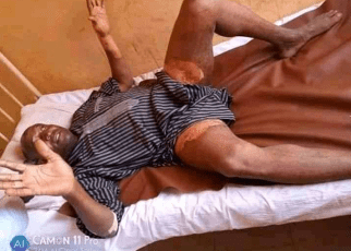 Woman pours hot water on husband private's over plans to marry a second wife.